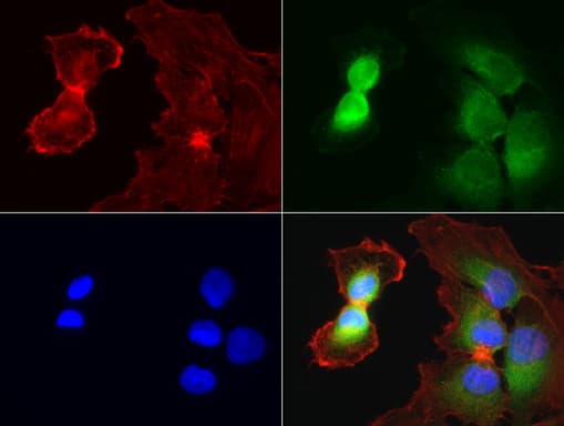 WIBG Antibody (clone UMAB207)