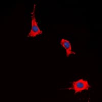 IHC-plus™ PTGER2 / EP2 Antibody (C-Terminus)