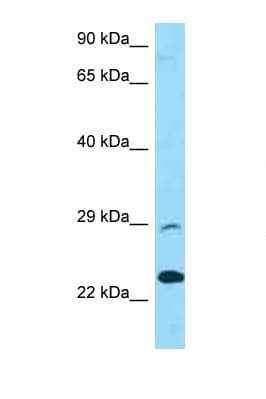 PRSS58 Antibody (aa122-171)
