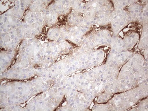 CD34 Antibody (aa312-385, clone OTI11E1)