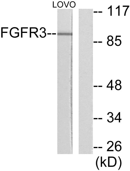 Polyclonal Rabbit anti-Human FGFR3 Antibody (aa131-180, IHC, WB)