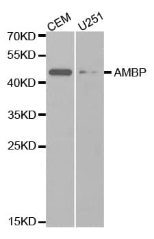 IHC-plus™ Polyclonal Rabbit anti-Human AMBP Antibody (IHC, WB)