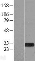 MXI1 / MAD2 Protein (Over-Expression Lysate Myc-DDK (Flag))
