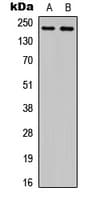 IHC-plus™ PLXNA4 / Plexin A4 Antibody (Internal)