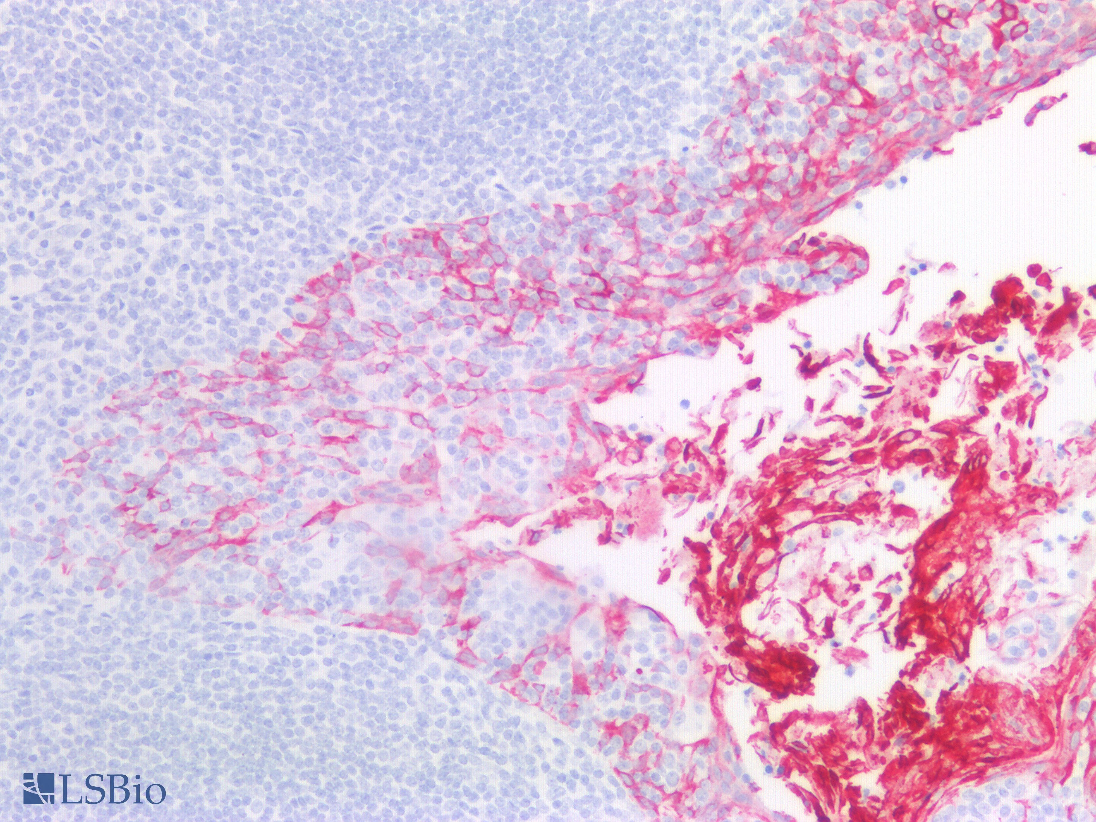 PathPlus™ Keratin, HMW Antibody (clone 34BE12)