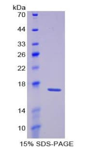 Rat LAMA1 / Laminin Alpha 1 Protein (Recombinant His-T7)