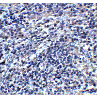 ORAI3 Antibody