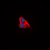 PPP1R14C / KEPI Antibody (Internal)