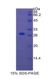 Human ITGA2 / CD49b Protein (Recombinant His-S)
