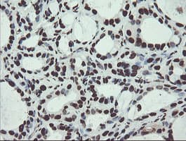 Monoclonal Mouse anti-Human NONO / P54NRB Antibody (clone OTI2E7, IHC, WB)
