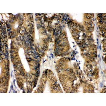 Polyclonal Rabbit anti-Human MAPK13 / p38delta Antibody (aa332-365, IHC, WB)