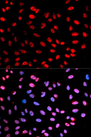 ESPL1 / Separase Antibody (phospho-Ser1126)
