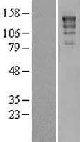 ERCC5 / XPG Protein (Over-Expression Lysate Myc-DDK (Flag))