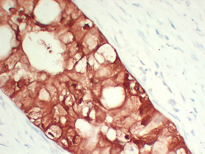 S100A6 / Calcyclin Antibody (clone ABT-S100A6)