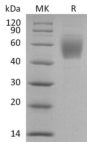 Coronavirus SARS-CoV-2 Spike Glycoprotein (Recombinant 6His, C-terminus)