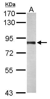 Polyclonal Rabbit anti-Human PNPT1 Antibody (aa25-251, IHC, WB)