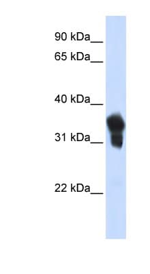 MLX / TCFL4 Antibody (aa72-121)