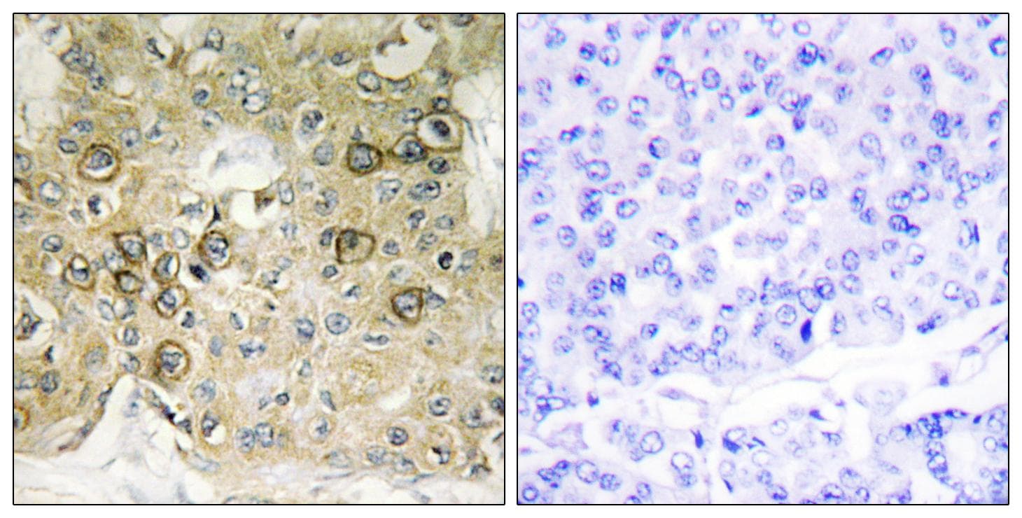 Polyclonal Rabbit anti-Human ITGB1 / Integrin Beta 1 / CD29 Antibody (phospho-Thr789, IHC, IF, WB)