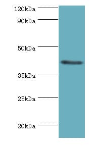 Polyclonal Rabbit anti-Human FUT6 Antibody (aa170-359, IHC, WB)