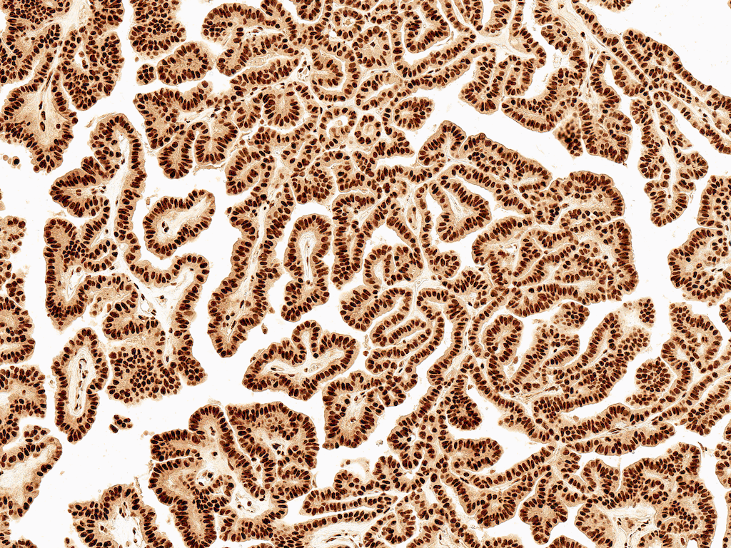 WNT5A Antibody