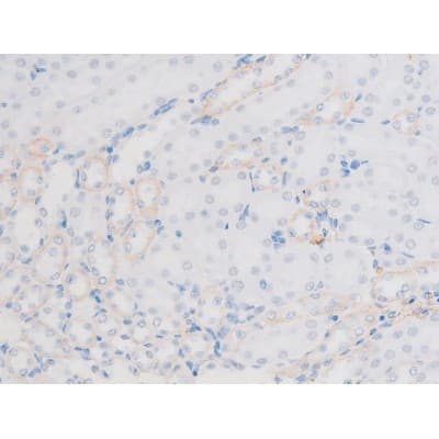 LIMK1 / LIMK Antibody (phospho-Thr508)