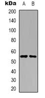 STK32C / PKE Antibody (Internal)