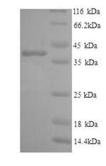 Human IL6R / IL6 Receptor Protein (Recombinant 6His, N-terminus)