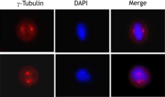TUBG1 / Tubulin Gamma 1 Antibody (clone 14C11)