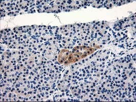 TBC1D21 Antibody (clone OTI3C2, Carrier-free)