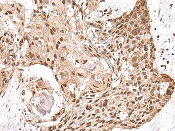 MAGOHB / Mago Antibody