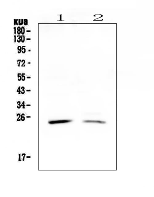 Polyclonal Rabbit anti-Human STAR Antibody (WB)