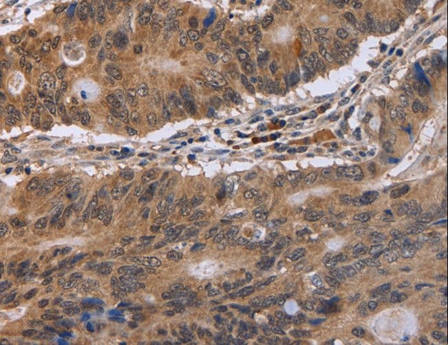 EIF3H / EIF3S3 Antibody