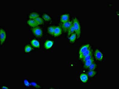 LHCGR / LHR / LH Receptor Antibody (aa27-363)