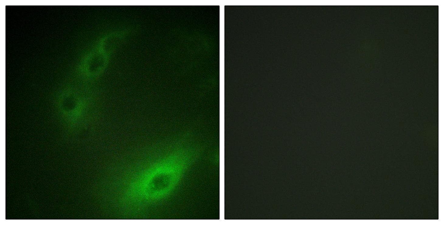 FOXO1 / FKHR Antibody (p329)