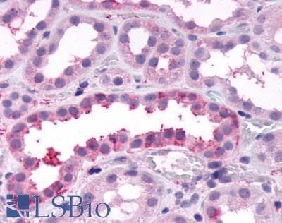 PathPlus™ FZD4 / Frizzled 4 Antibody (C-Terminus)