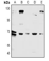Polyclonal Rabbit anti-Human CDC25A Antibody (WB)