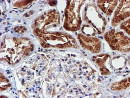 CYP17 / CYP17A1 Antibody (clone OTI3F11)