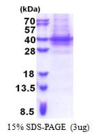 Human PIH1D1 Protein (Recombinant His)