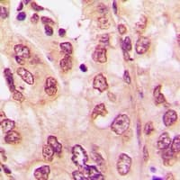 FBXW7 / FBW7 Antibody