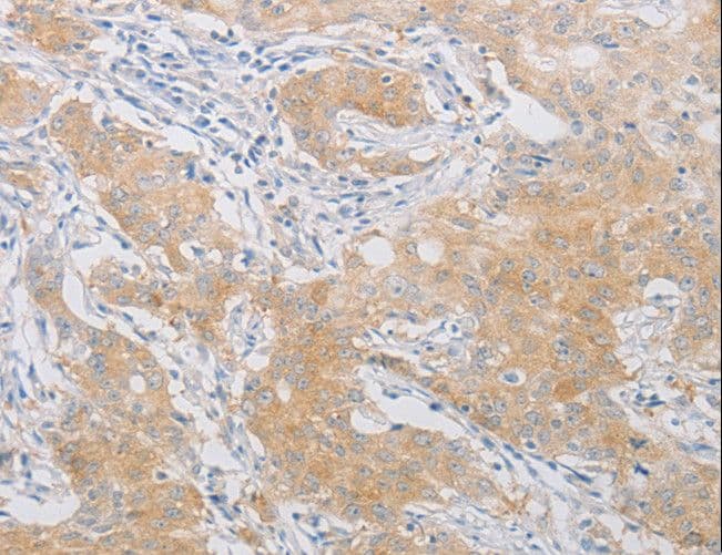 Polyclonal Rabbit anti-Human PDE4D Antibody (IHC, WB)