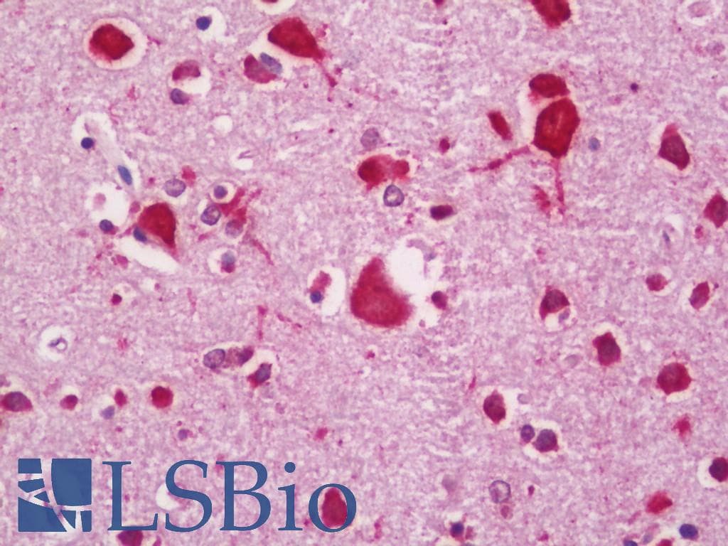 IHC-plus™ XBP1 Antibody (clone 3H1G4)
