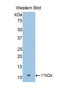 NPM1 / NPM / Nucleophosmin Antibody (aa212-292)