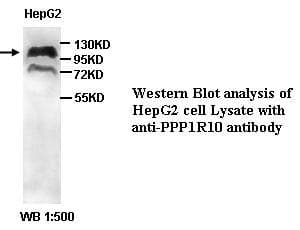 IHC-plus™ PPP1R10 / PNUTS Antibody