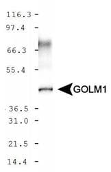 GOLM1 / GP73 / GOLPH2 Antibody (aa250-400)