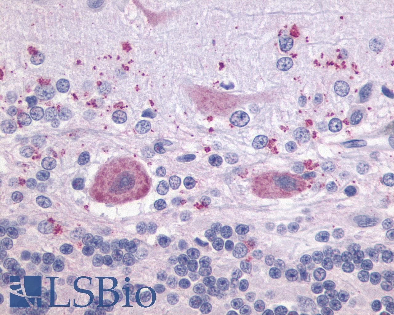PathPlus™ Polyclonal Rabbit anti-Human LPAR4 / GPR23 Antibody (Cytoplasmic Domain, IHC)