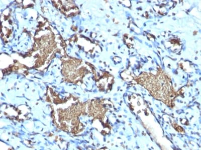 PathPlus™ Recombinant Monoclonal Rabbit anti-Human GYPA / CD235a / Glycophorin A Antibody (clone GYPA/1725R, IHC)