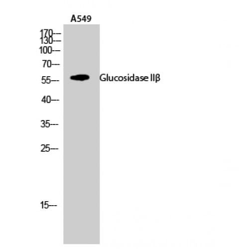 PRKCSH Antibody (50-130 aa, Internal)