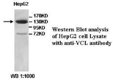 IHC-plus™ VCL / Vinculin Antibody (aa356-607)