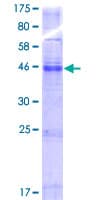 Human TMEM184C Protein (Recombinant GST)