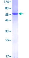 Human BAG1 / BAG-1 Protein (Recombinant GST)